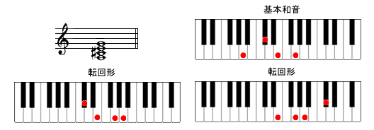 A7sAmR[h摜